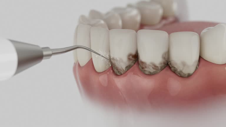 Reliable Dental contractor in Bellevue, ID by Smile Center Dentistry
